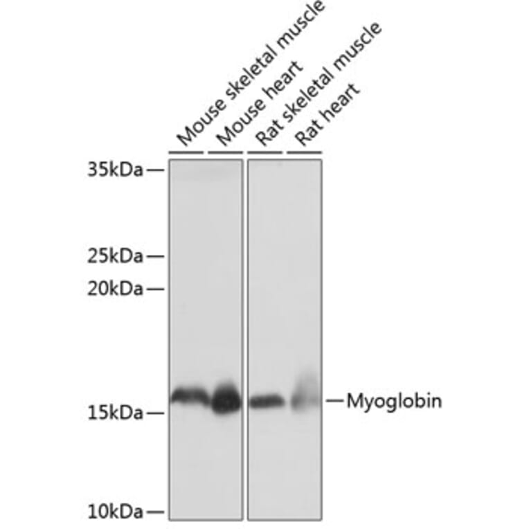 Western Blot - Anti-Myoglobin Antibody [ARC0582] (A80498) - Antibodies.com