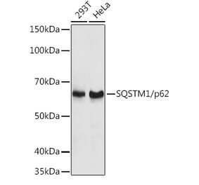 Western Blot - Anti-SQSTM1 / p62 Antibody (A80499) - Antibodies.com