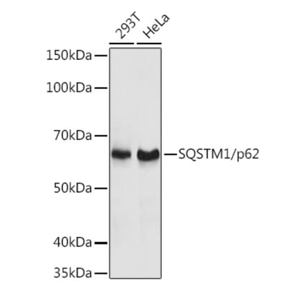 Western Blot - Anti-SQSTM1 / p62 Antibody (A80499) - Antibodies.com