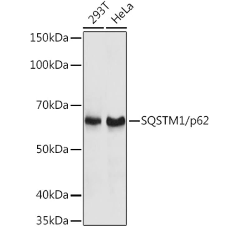 Western Blot - Anti-SQSTM1/p62 Antibody (A80499) - Antibodies.com