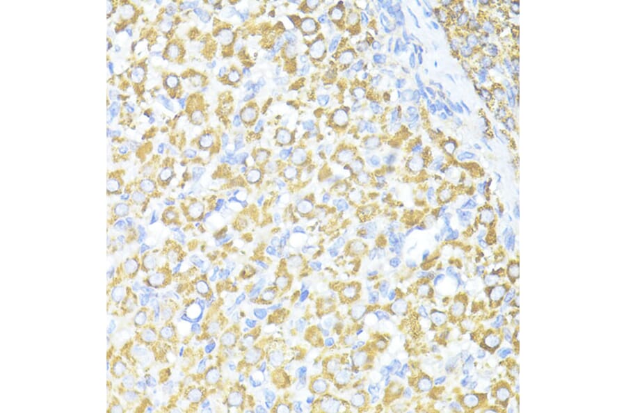 Immunohistochemistry - Anti-SQSTM1/p62 Antibody (A80499) - Antibodies.com