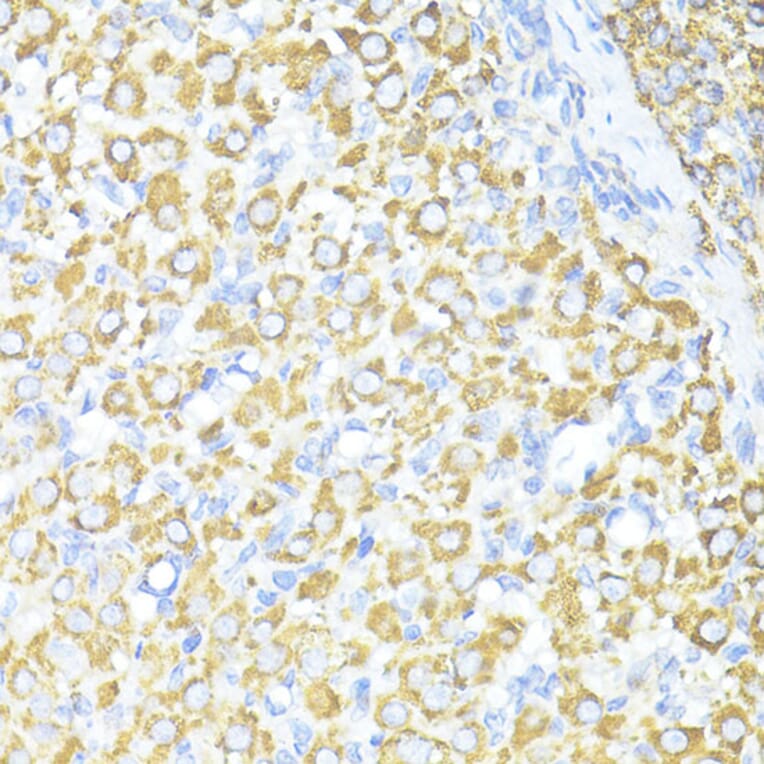 Immunohistochemistry - Anti-SQSTM1/p62 Antibody (A80499) - Antibodies.com