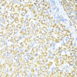 Immunohistochemistry - Anti-SQSTM1/p62 Antibody (A80499) - Antibodies.com