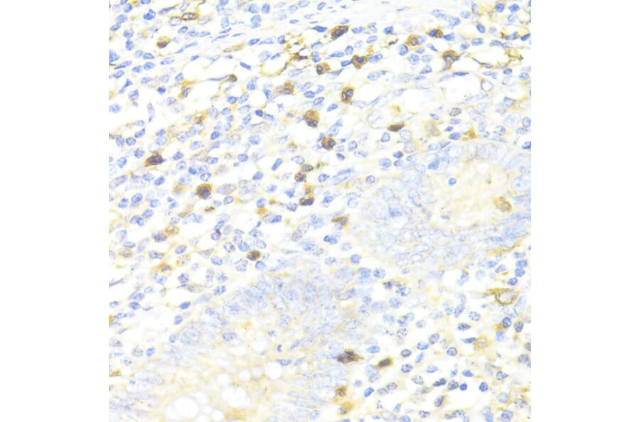 Immunohistochemistry - Anti-SQSTM1/p62 Antibody (A80499) - Antibodies.com