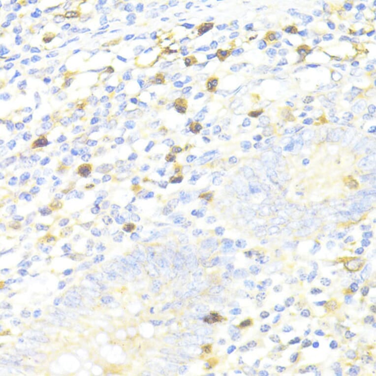 Immunohistochemistry - Anti-SQSTM1/p62 Antibody (A80499) - Antibodies.com