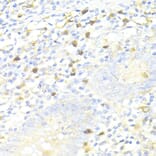 Immunohistochemistry - Anti-SQSTM1/p62 Antibody (A80499) - Antibodies.com