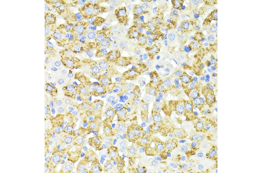 Immunohistochemistry - Anti-SQSTM1/p62 Antibody (A80499) - Antibodies.com