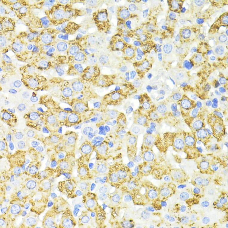 Immunohistochemistry - Anti-SQSTM1/p62 Antibody (A80499) - Antibodies.com
