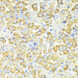 Immunohistochemistry - Anti-SQSTM1/p62 Antibody (A80499) - Antibodies.com