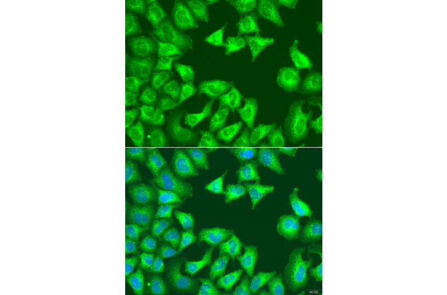 Immunofluorescence - Anti-SQSTM1/p62 Antibody (A80499) - Antibodies.com