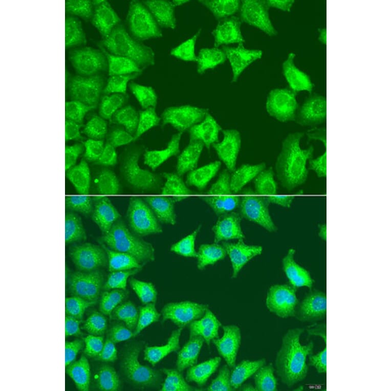 Immunofluorescence - Anti-SQSTM1/p62 Antibody (A80499) - Antibodies.com