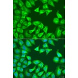 Immunofluorescence - Anti-SQSTM1/p62 Antibody (A80499) - Antibodies.com