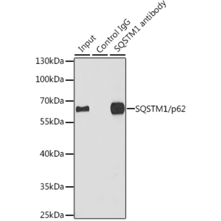 Western Blot - Anti-SQSTM1/p62 Antibody (A80499) - Antibodies.com