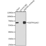 Western Blot - Anti-SQSTM1/p62 Antibody (A80499) - Antibodies.com