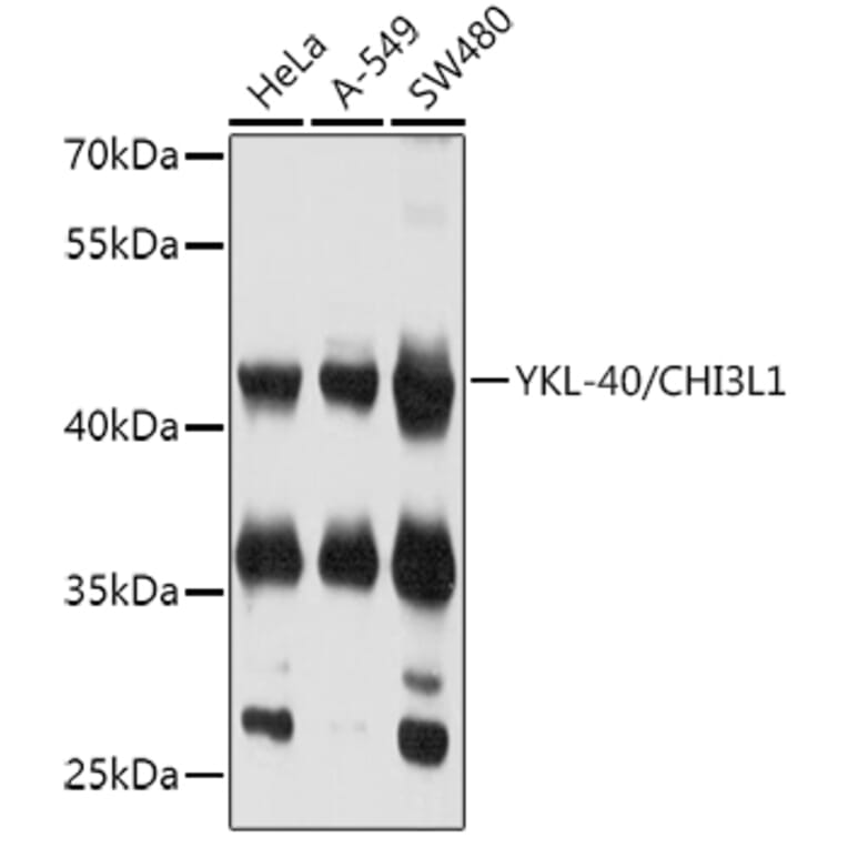 Western Blot - Anti-YKL-40 / CHI3L1 Antibody (A80500) - Antibodies.com