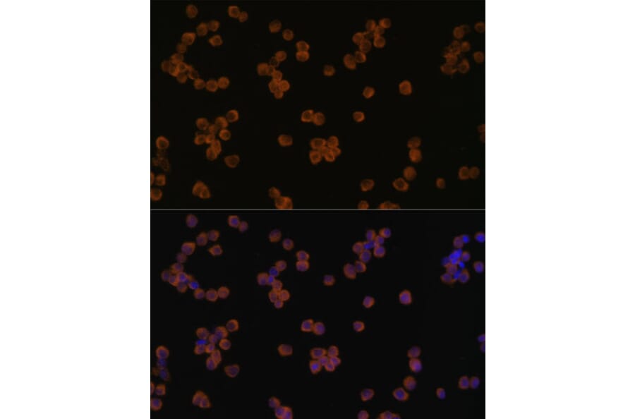 Immunofluorescence - Anti-YKL-40 / CHI3L1 Antibody (A80500) - Antibodies.com