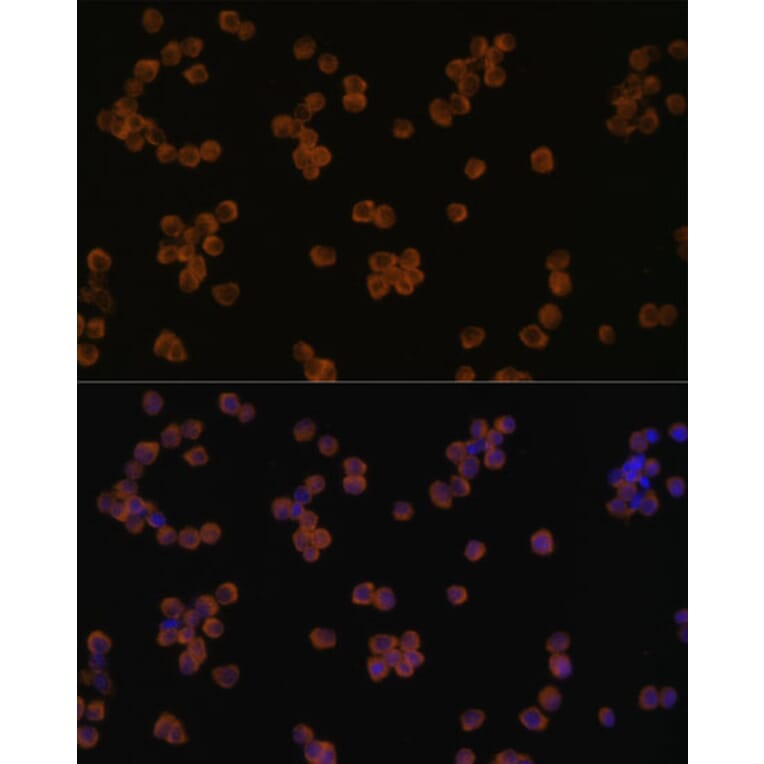Immunofluorescence - Anti-YKL-40 / CHI3L1 Antibody (A80500) - Antibodies.com