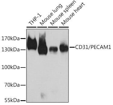 Western blot analysis of extracts of various cell lines, using Anti-PECAM1 Antibody (A11525) at 1:1,000 dilution.
Secondary antibody: Goat Anti-Rabbit IgG (H+L) (HRP) (AS014) at 1:10,000 dilution.
Lysates / proteins: 25µg per lane.
Blocking buffer: 3% non-fat dry milk in TBST.
Detection: ECL Basic Kit (RM00020).
Exposure time: 30s.