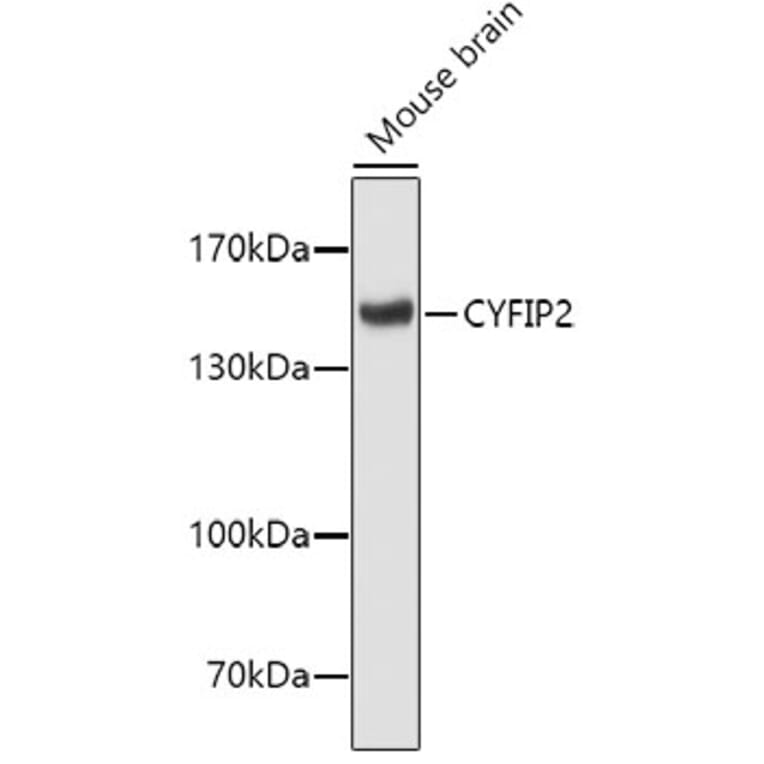 Western Blot - Anti-CYFIP2 Antibody (A4632) - Antibodies.com