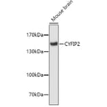 Western Blot - Anti-CYFIP2 Antibody (A4632) - Antibodies.com