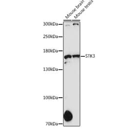 Western Blot - Anti-STK36 Antibody (A80504) - Antibodies.com
