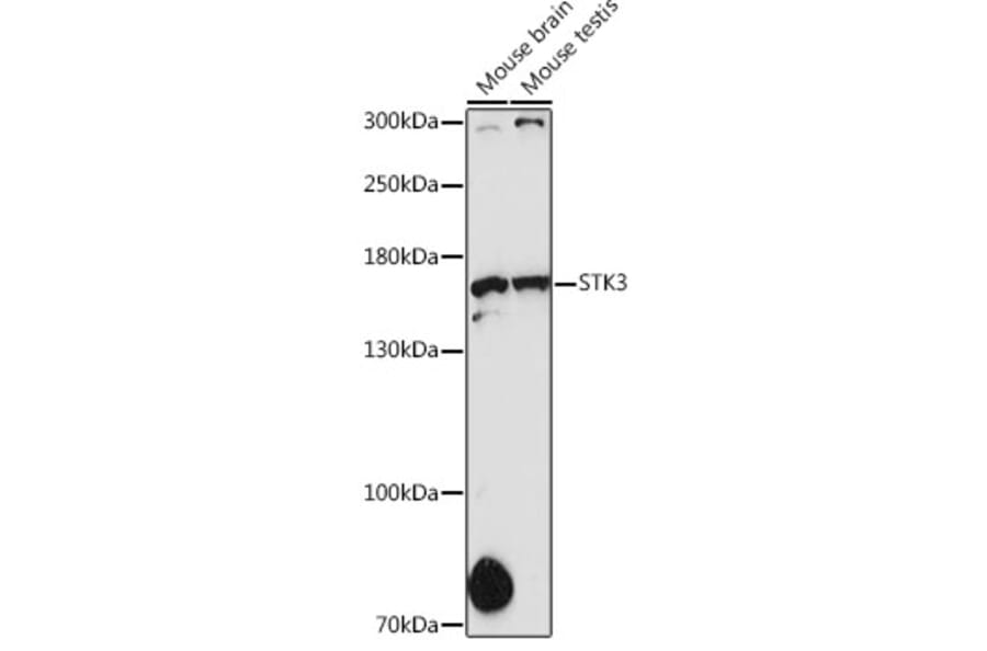 Western Blot - Anti-STK36 Antibody (A80504) - Antibodies.com