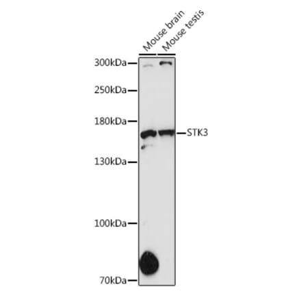 Western Blot - Anti-STK36 Antibody (A80504) - Antibodies.com