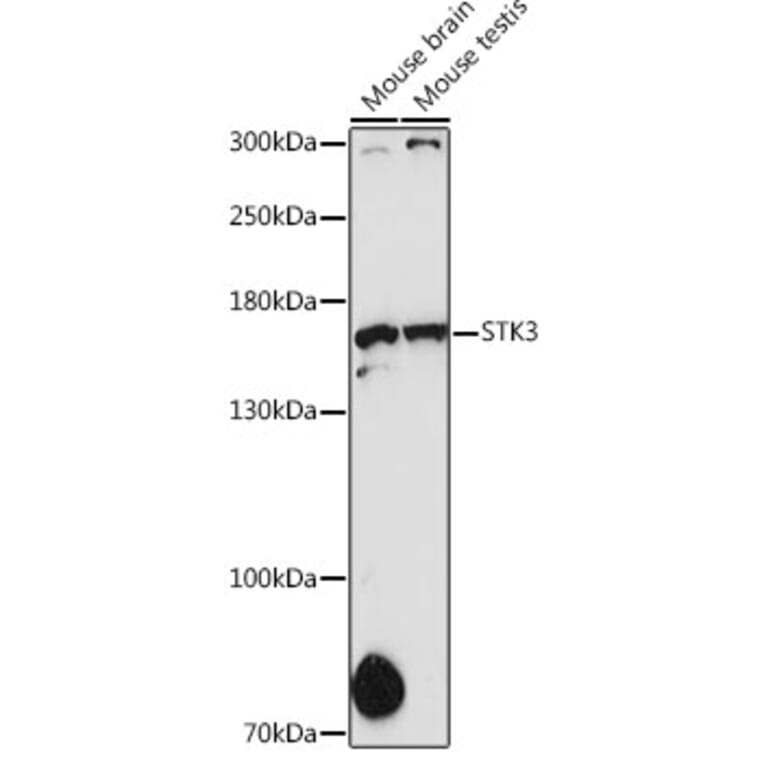 Western Blot - Anti-STK36 Antibody (A80504) - Antibodies.com