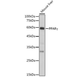 Western Blot - Anti-PPAR gamma Antibody (A80505) - Antibodies.com