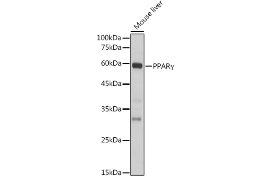 Western Blot - Anti-PPAR gamma Antibody (A80505) - Antibodies.com