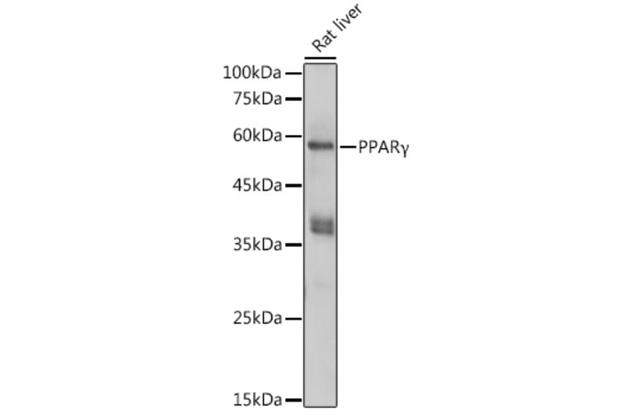 Western Blot - Anti-PPAR gamma Antibody (A80505) - Antibodies.com