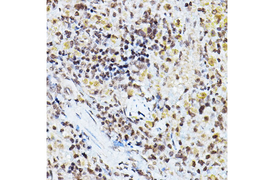 Immunohistochemistry - Anti-PPAR gamma Antibody (A80505) - Antibodies.com