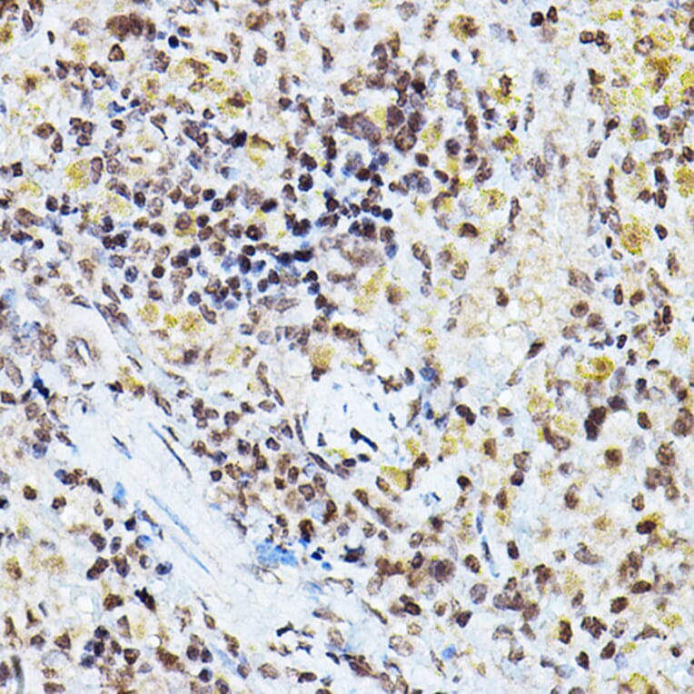 Immunohistochemistry - Anti-PPAR gamma Antibody (A80505) - Antibodies.com