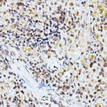 Immunohistochemistry - Anti-PPAR gamma Antibody (A80505) - Antibodies.com