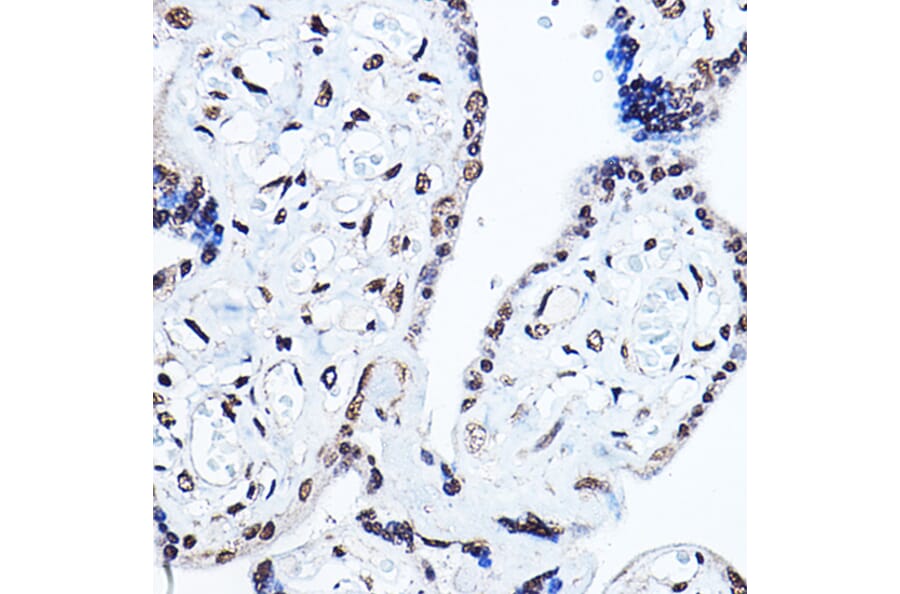 Immunohistochemistry - Anti-PPAR gamma Antibody (A80505) - Antibodies.com
