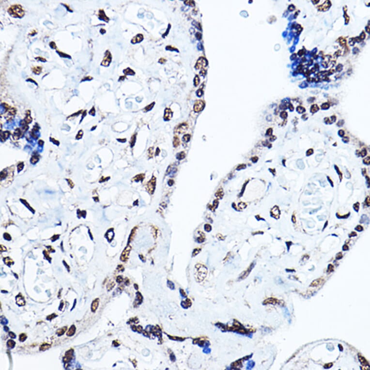 Immunohistochemistry - Anti-PPAR gamma Antibody (A80505) - Antibodies.com