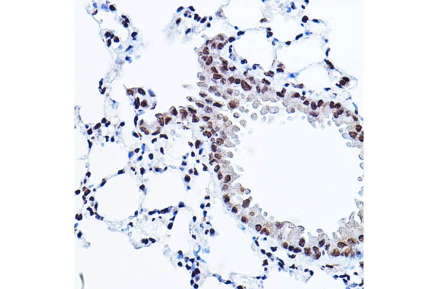 Immunohistochemistry - Anti-PPAR gamma Antibody (A80505) - Antibodies.com