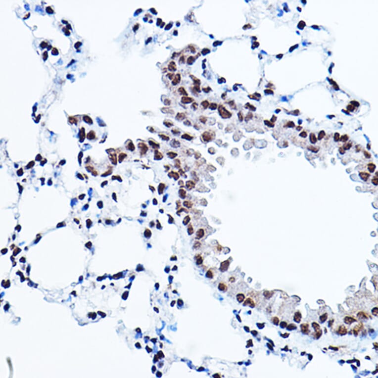 Immunohistochemistry - Anti-PPAR gamma Antibody (A80505) - Antibodies.com
