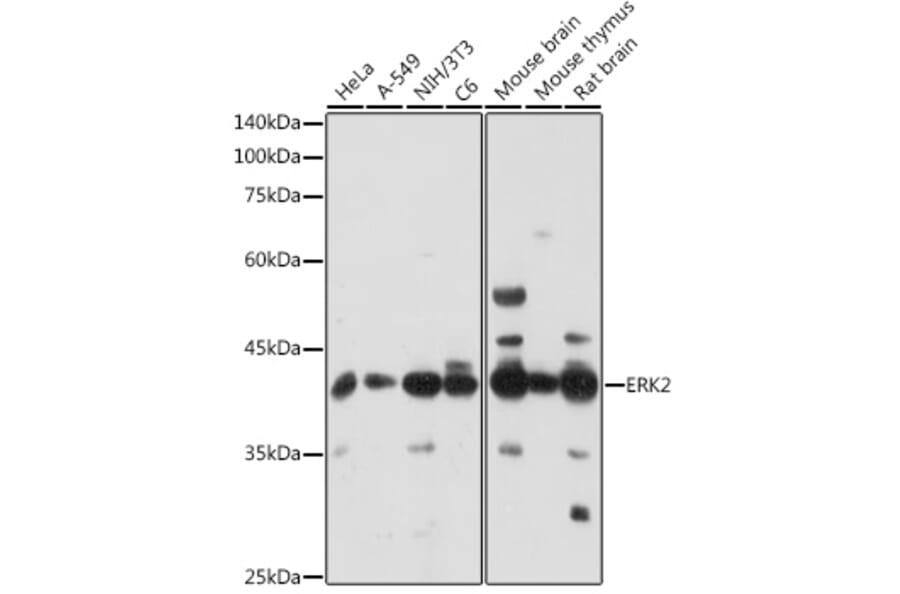 Western Blot - Anti-ERK2 Antibody (A80506) - Antibodies.com