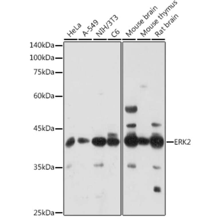 Western Blot - Anti-ERK2 Antibody (A80506) - Antibodies.com