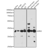 Western Blot - Anti-ERK2 Antibody (A80506) - Antibodies.com