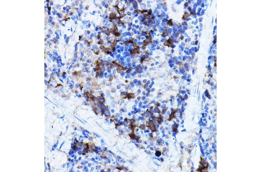 Immunohistochemistry - Anti-ERK2 Antibody (A80506) - Antibodies.com