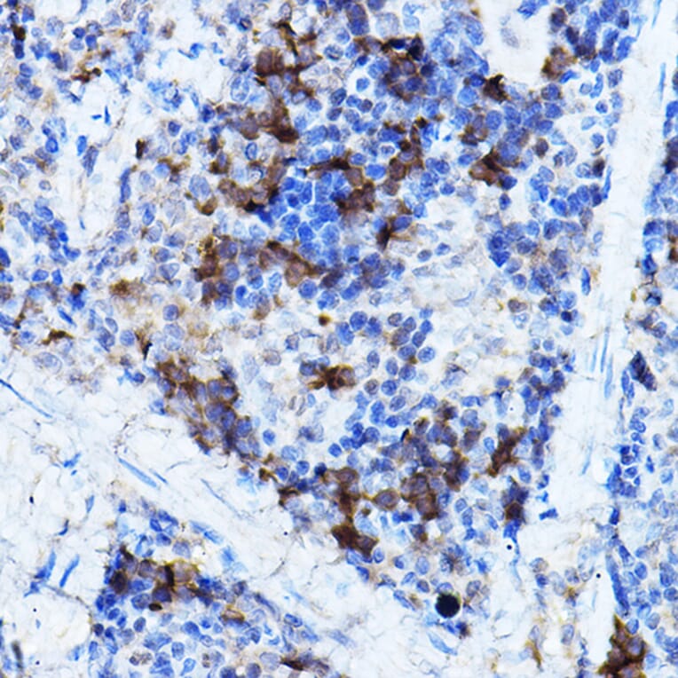 Immunohistochemistry - Anti-ERK2 Antibody (A80506) - Antibodies.com