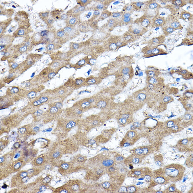 Immunohistochemistry - Anti-ERK2 Antibody (A80506) - Antibodies.com