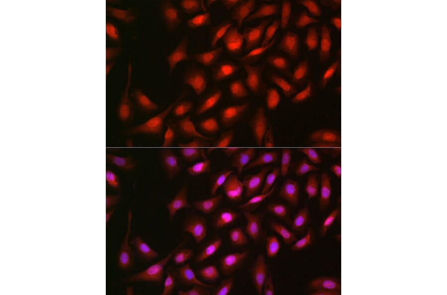 Immunofluorescence - Anti-ERK2 Antibody (A80506) - Antibodies.com