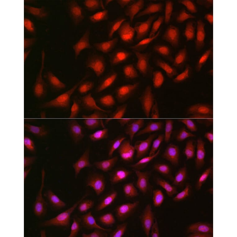 Immunofluorescence - Anti-ERK2 Antibody (A80506) - Antibodies.com