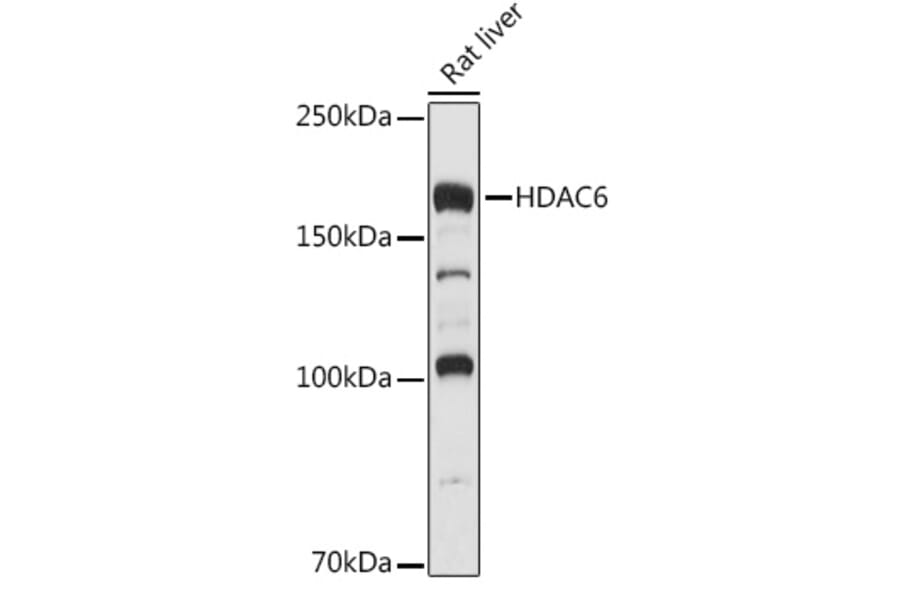 Western Blot - Anti-HDAC6 Antibody (A80508) - Antibodies.com