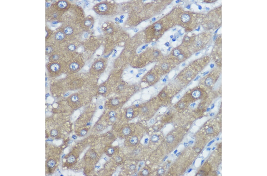 Immunohistochemistry - Anti-HDAC6 Antibody (A80508) - Antibodies.com