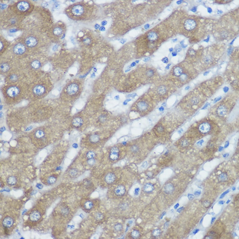 Immunohistochemistry - Anti-HDAC6 Antibody (A80508) - Antibodies.com