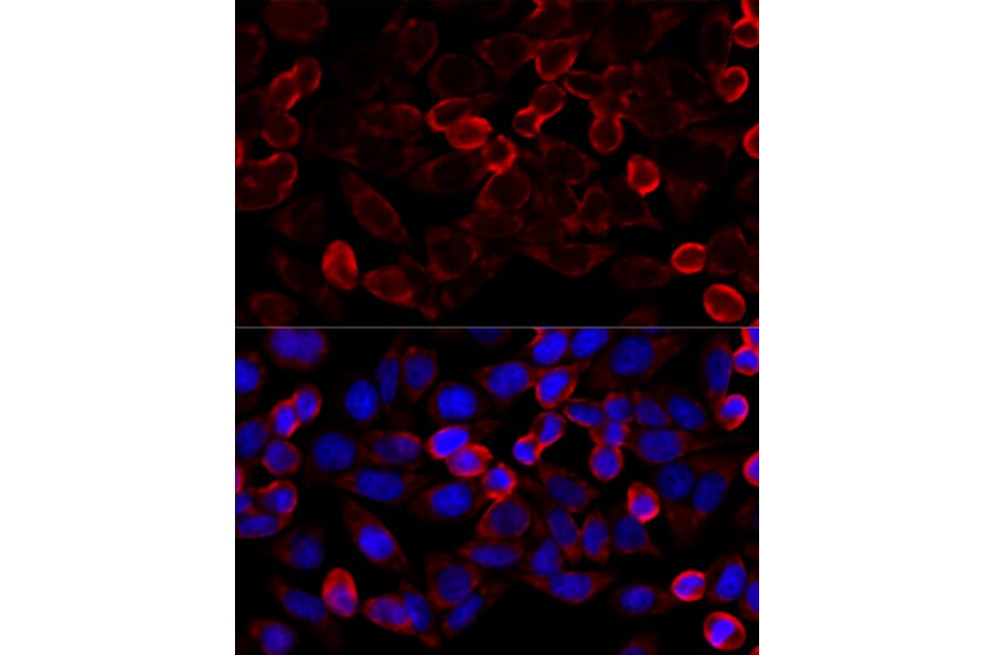 Immunofluorescence - Anti-HDAC6 Antibody (A80508) - Antibodies.com